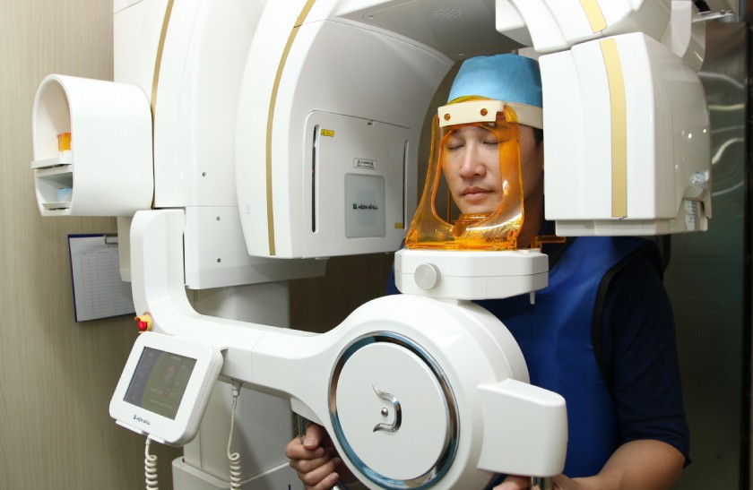 Chụp phim X-quang CT Cone Beam 3D Chụp phim X-quang CT Cone Beam 3D