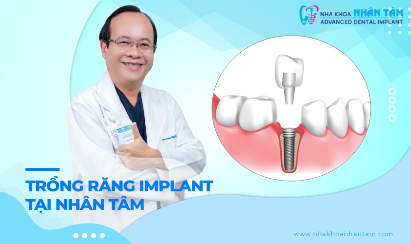 5 ưu thế vượt trội khi trồng răng Implant tại Nhân Tâm