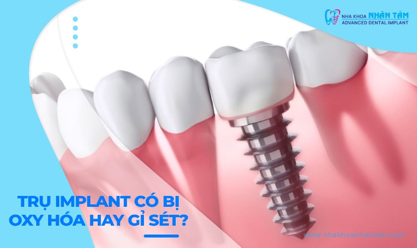 Trụ Implant có bị oxy hoá hay gỉ sét theo thời gian không?