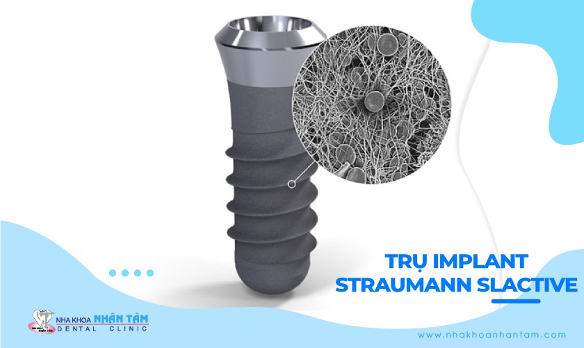 Những thông tin cần biết về trụ Implant Straumann SLActive