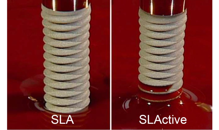 Implant Straumann SLActive được các chuyên gia đánh giá cao