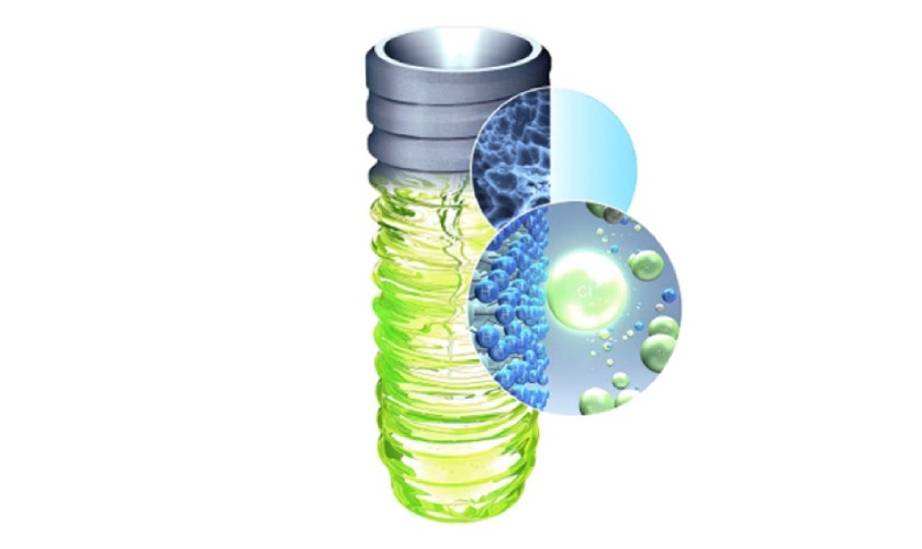 Implant Straumann SLActive giúp tích hợp xương nhanh chóng