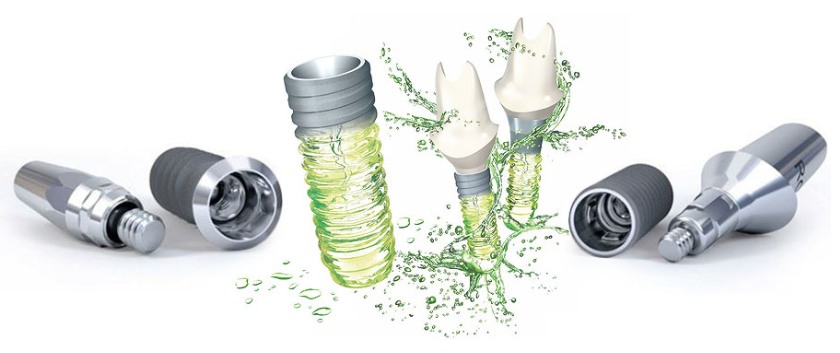 Chi phí cấy ghép trụ Implant Straumann SLActive phụ thuộc vào rất nhiều yếu tố