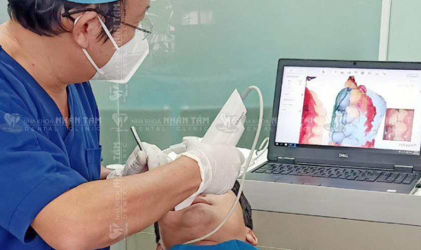 Lấy dấu răng kỹ thuật số nhẹ nhàng, chuẩn xác với công nghệ Oral Scanner