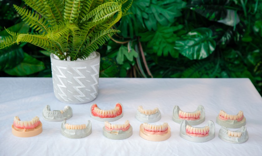 Phục hình Implant bền đẹp với vật liệu sườn sinh học BioHPP, Visio.lign