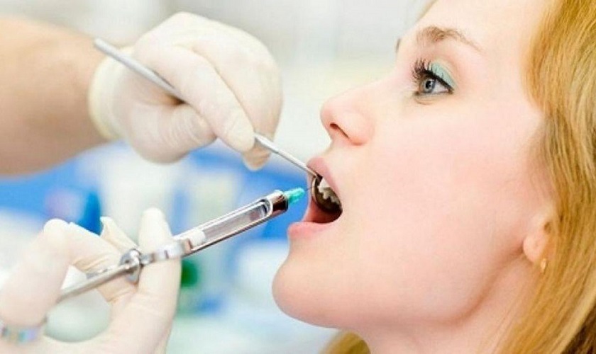 Trong một số trường hợp cần thiết, bác sĩ sẽ gây tê cục bộ tại vị trí răng cần trám