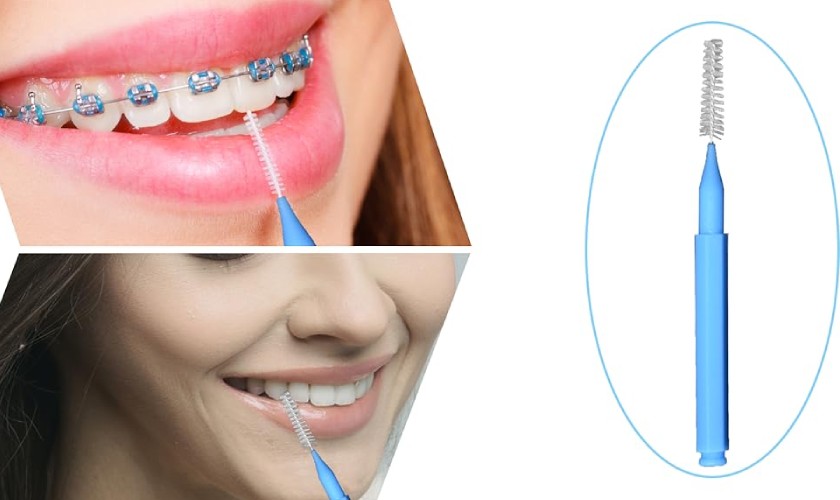 Lựa chọn bàn chải kẽ răng phù hợp