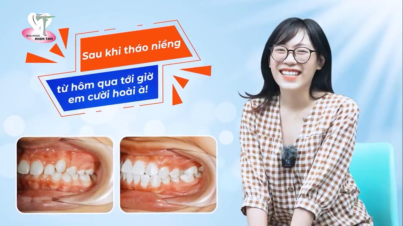 Khách hàng niềng răng tại Nha khoa Nhân Tâm