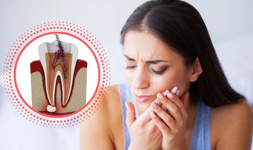 Răng bị đau nhức sau khi lấy tủy