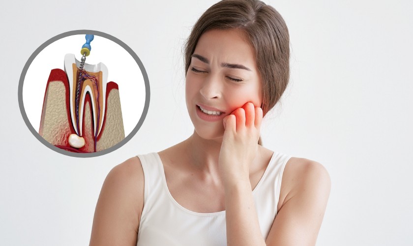 Có nhiều nguyên nhân khiến răng bị đau nhức sau khi lấy tủy