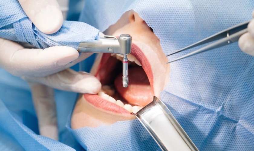 Cần thăm khám bác sĩ để xử lý các triệu chứng bất thường sau khi lấy tủy