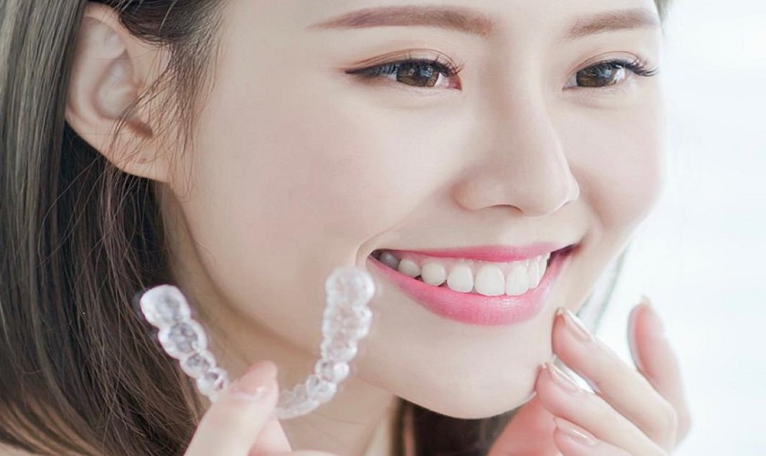 Có nên niềng răng Invisalign hay không?