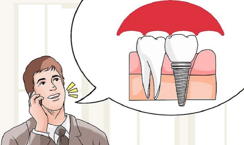 Có nên trồng răng Implant không? Ai nên cấy ghép Implant