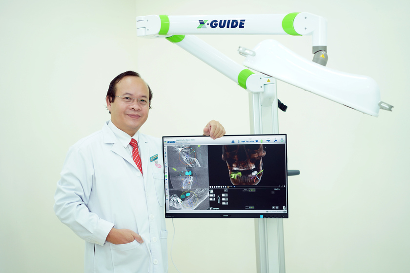 Công nghệ định vị là công nghệ tiên tiến nhất hiện nay trong Implant Nha khoa