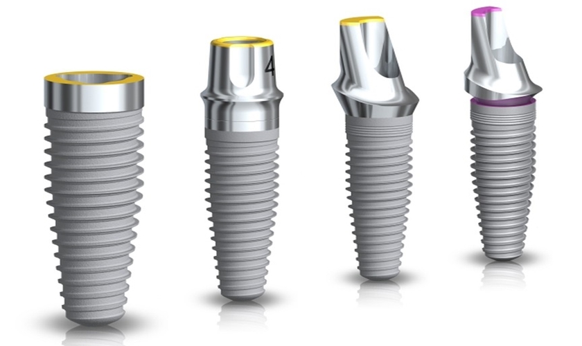 Cấy ghép implant bằng công nghệ định vị có thể áp dụng cho tất cả hệ thống implant