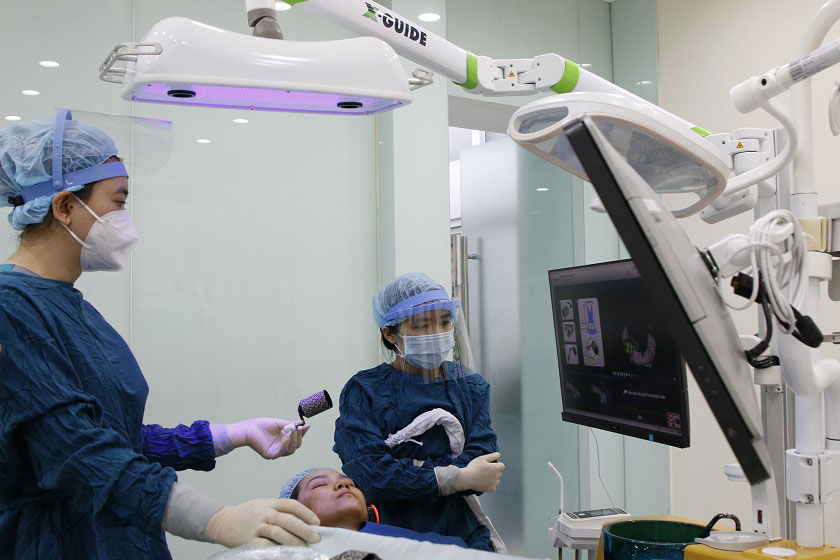 Tại sao nên trồng răng implant bằng Công nghệ định vị X-guide?