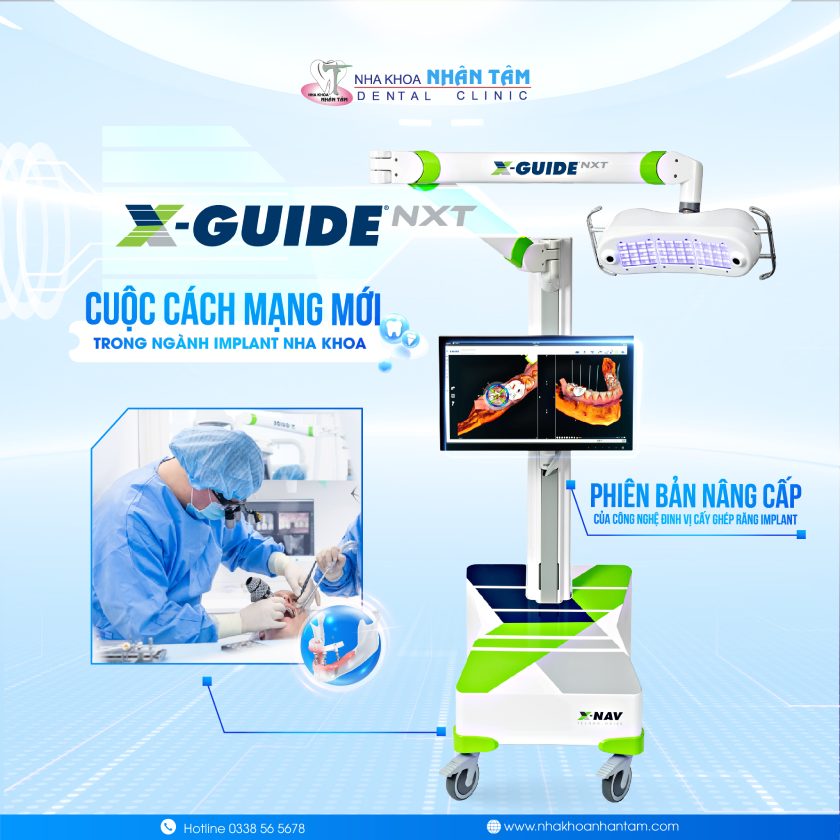 X-Guide NXT - Cuộc cách mạng mới trong ngành Implant nha khoa X-Guide NXT - Cuộc cách mạng mới trong ngành Implant nha khoa