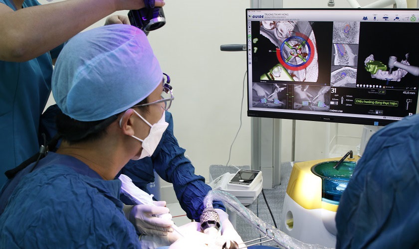 Khách hàng muốn trải nghiệm công nghệ X-Guide NXT lần đầu tiên tại Việt Nam - Đến ngay Nha khoa Nhân Tâm Khách hàng muốn trải nghiệm công nghệ X-Guide NXT lần đầu tiên tại Việt Nam - Đến ngay Nha khoa Nhân Tâm