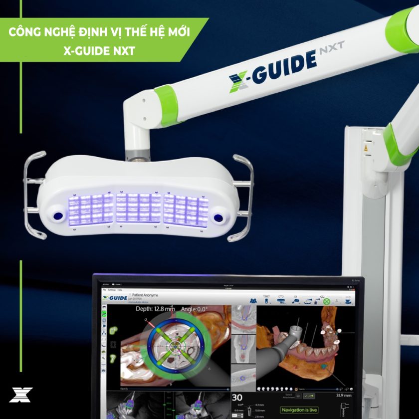 X-Guide NXT có thiết kế nhỏ gọn hơn nhưng mang lại hiệu quả vượt trội hơn