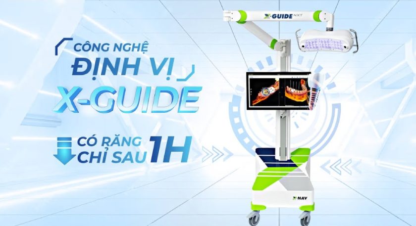 Công nghệ X-Guide NXT mang đến những hiệu quả vượt trội