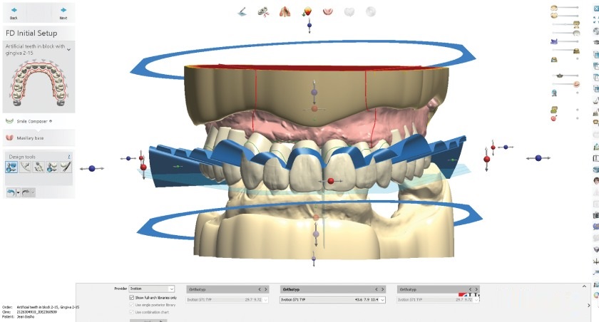 Công nghệ 3Shape giúp việc chế tác răng giả đạt độ chính xác cao