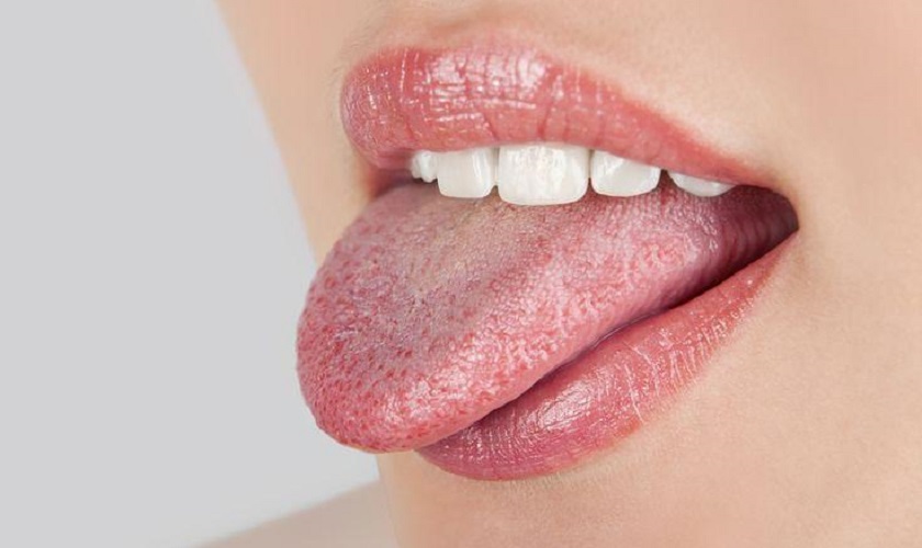 Đầu lưỡi nổi hột đỏ - Biểu hiện bệnh không thể xem thường