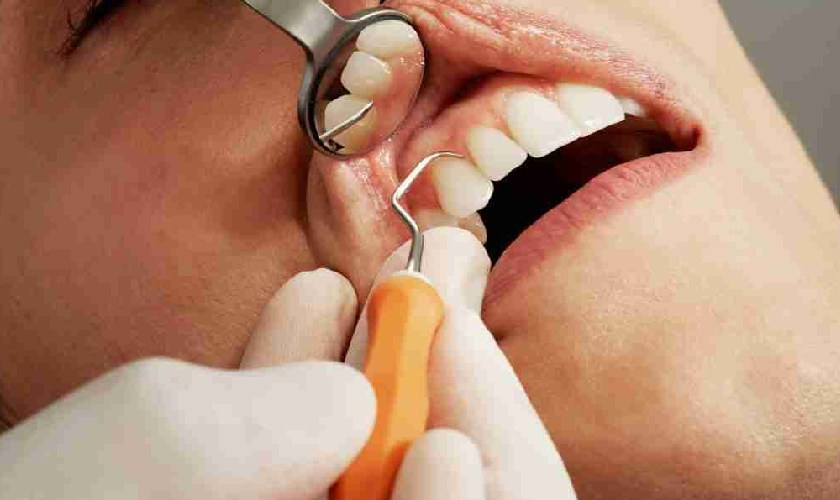 Điều trị áp xe răng cần phải được thực hiện tại địa chỉ uy tín