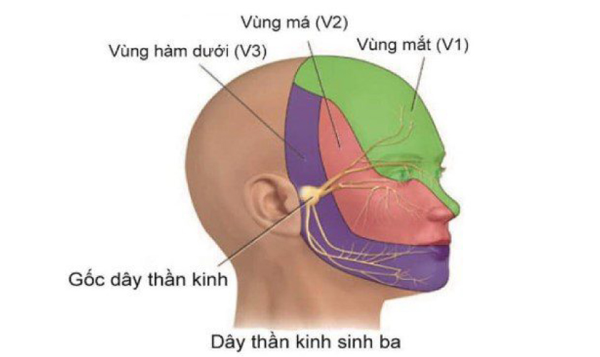 3 vùng bị đau do ảnh hưởng của dây thần kinh số 5 3 vùng bị đau do ảnh hưởng của dây thần kinh số 5