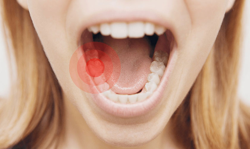 Thuốc giảm đau răng nào tốt nhất? 