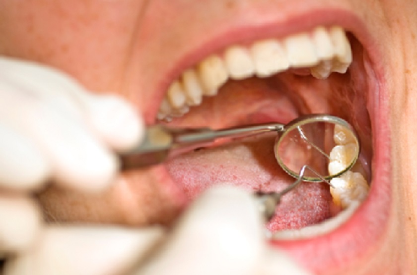 Quá trình điều trị các bệnh viêm tủy, sâu răng có thể gây đau