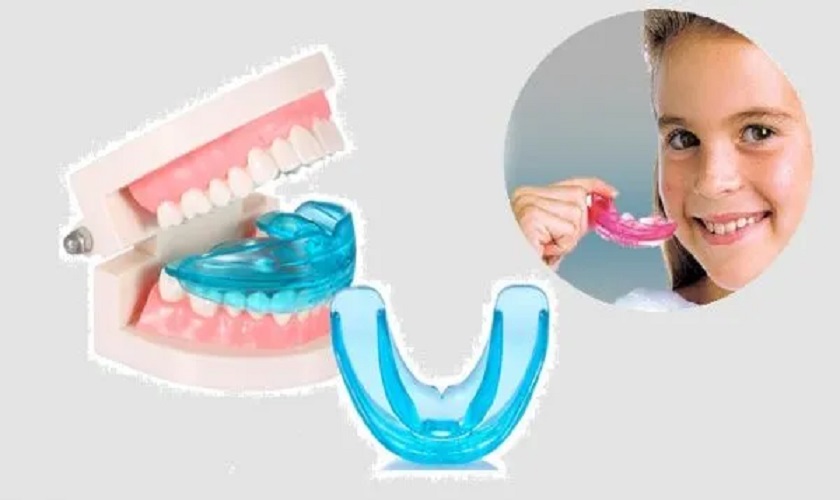 Dụng cụ chỉnh nha tại nhà thường được chỉ định cho trẻ nhỏ