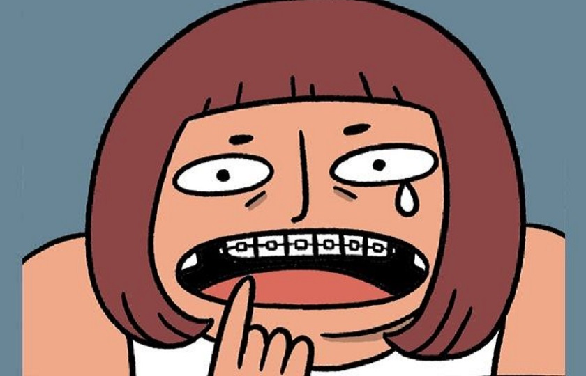 Nhổ răng niềng có ảnh hưởng đến thần kinh?