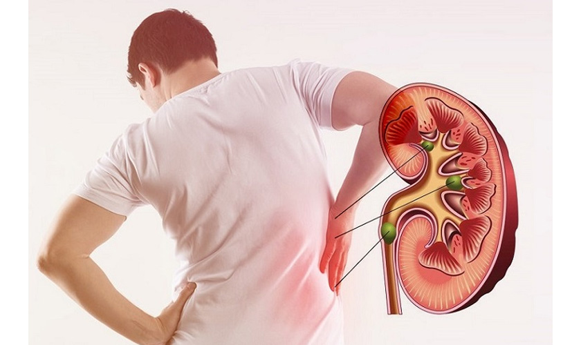 Bệnh suy thận cũng là nguyên nhân khiến hơi thở có mùi