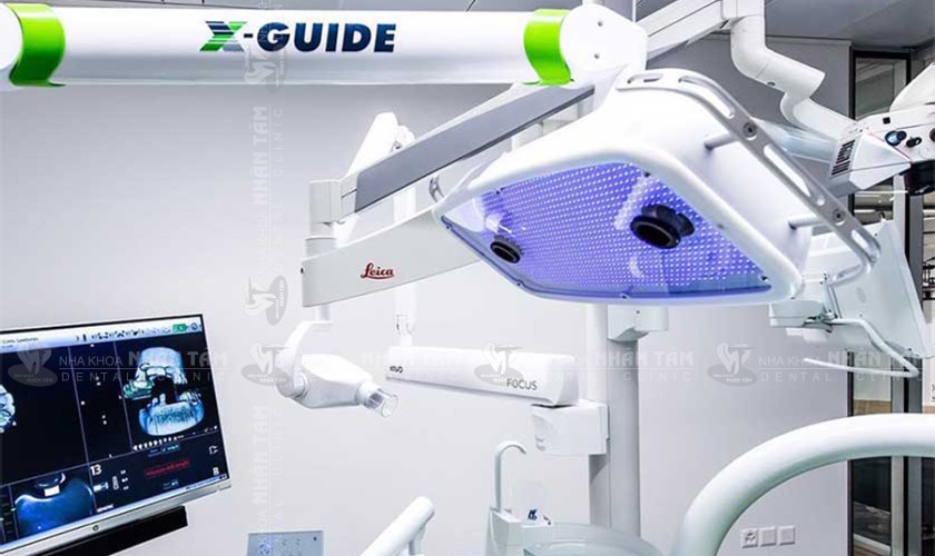 Công nghệ định vị X-Guide Công nghệ định vị X-Guide