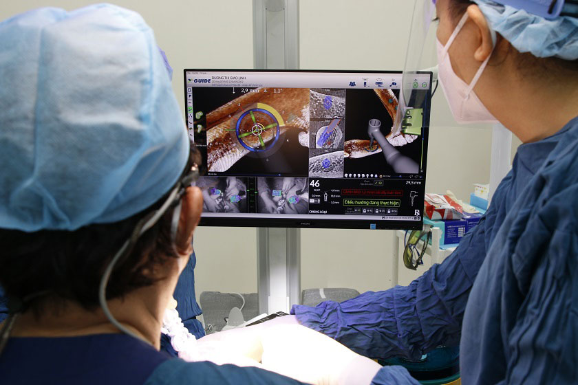 Ưu điểm của cấy ghép Implant tức thì