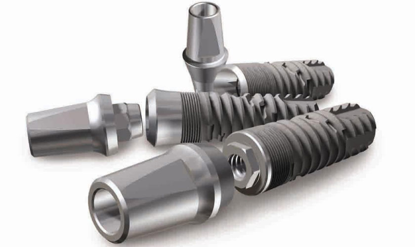 Chi phí trồng răng implant sẽ tùy thuộc vào chất liệu trụ implant mà bạn lựa chọn