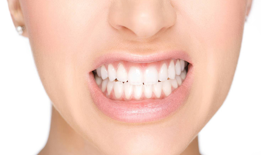 Nghiến răng là trường hợp chống chỉ định tương đối trong cấy ghép implant