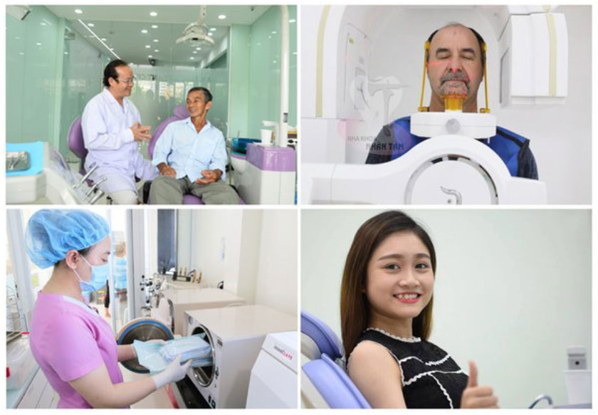 Hình ảnh khách hàng trước và sau khi trồng răng Implant tức thì