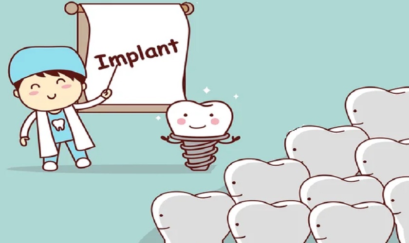 Trồng răng Implant giá tốt tại TPHCM