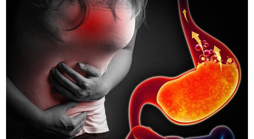 Trào ngược dịch mật