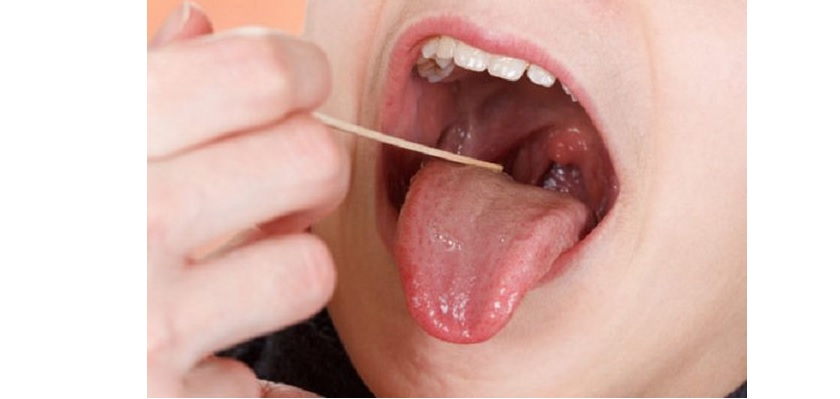 Có khá nhiều nguyên nhân dẫn đến tình trạng mọc mụn nước trong miệng