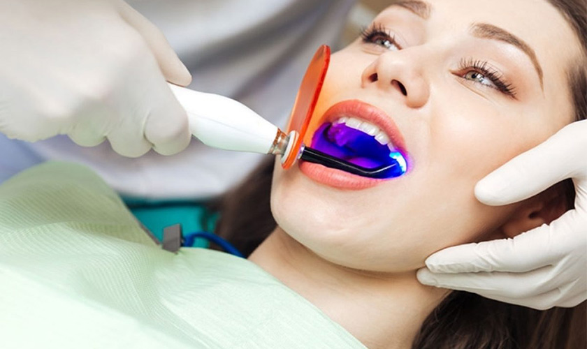 Tẩy trắng răng bằng tia Laser tại nha khoa