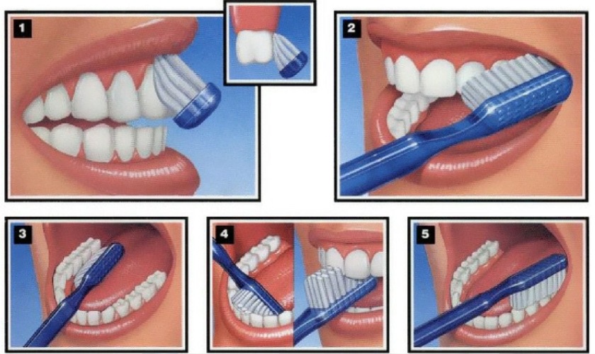 Chải răng đúng khoa học giúp bạn bảo vệ sức khỏe răng miệng