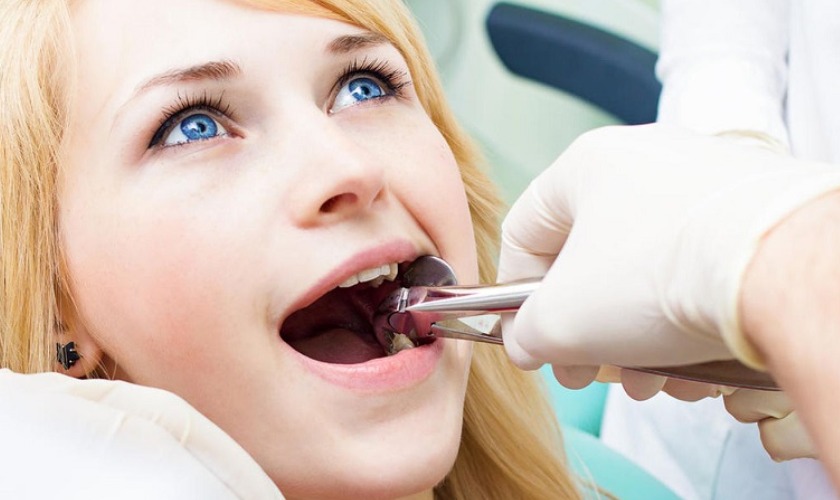 Nhổ răng được chỉ định trong những trường hợp răng hư không thể phục hồi