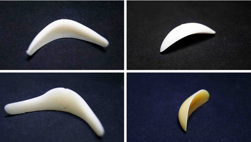 Phẫu thuật độn cằm bằng sụn nhân tạo