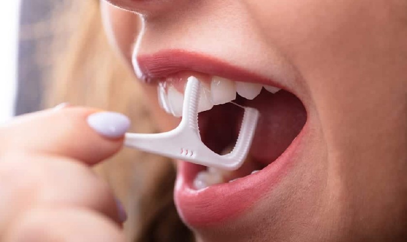 Chỉ nha khoa là gì? Hướng dẫn sử dụng đúng cách để bảo vệ nướu răng tại Nha khoa Bedental