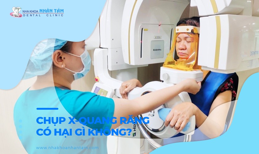 Chụp X-quang răng có hại gì không?