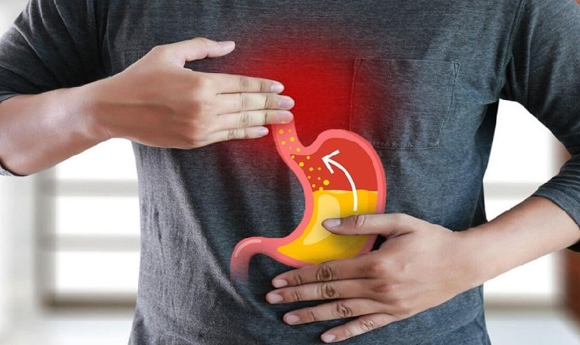 Trào ngược dạ dày có thể khiến miệng bị đắng