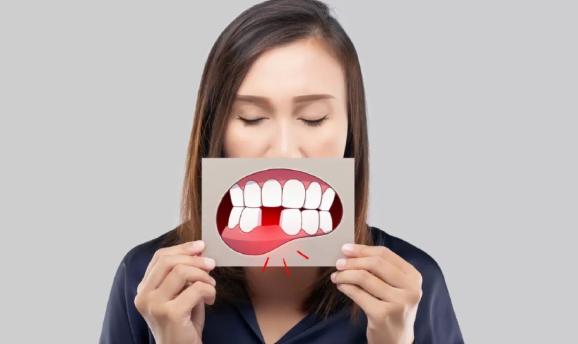 Hàm răng xấu khiến nụ cười kém duyên