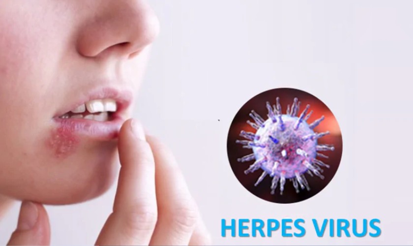 Hoại tử xương hàm là một căn bệnh vô cùng nguy hiểm Hoại tử xương hàm là một căn bệnh vô cùng nguy hiểm